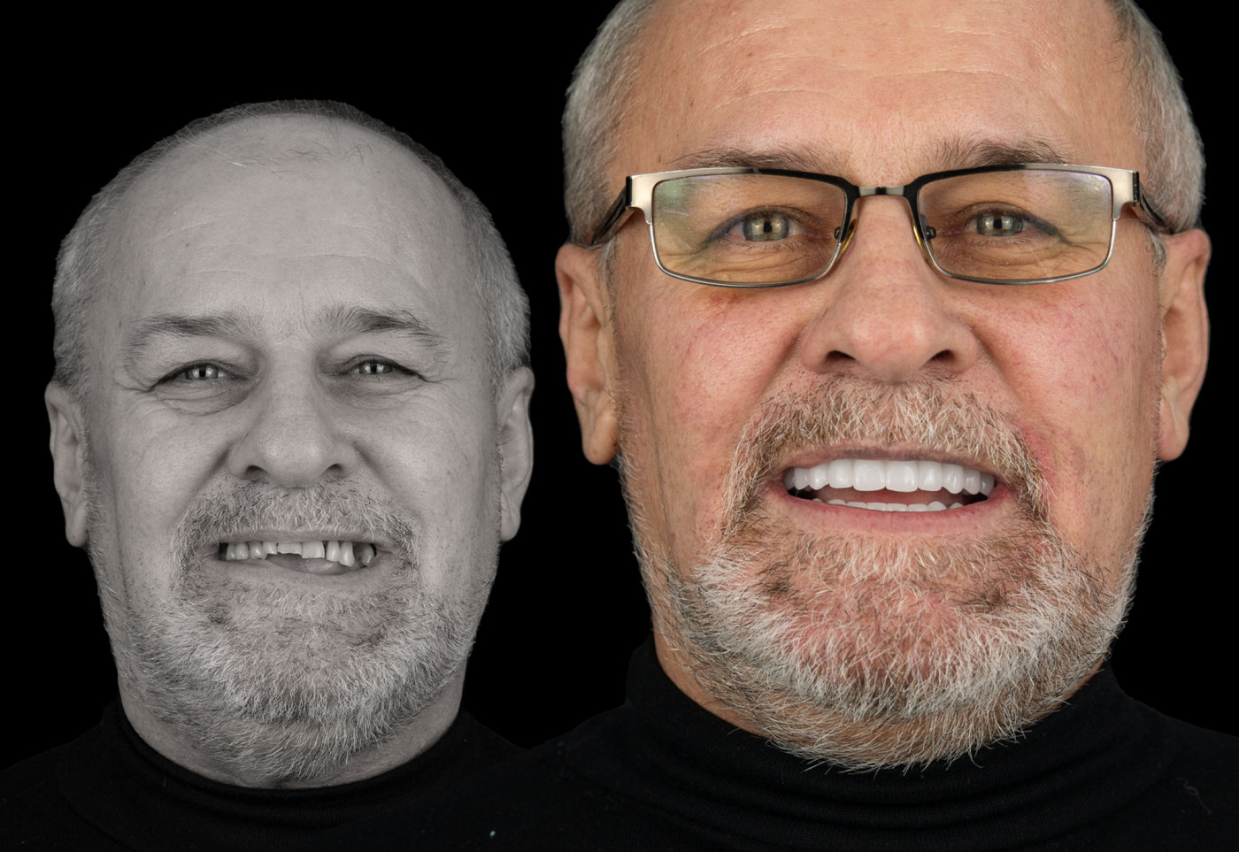 1 Albania Dental & Aesthetics - Turismo Dentale in Albania - Albania Dental Tourism