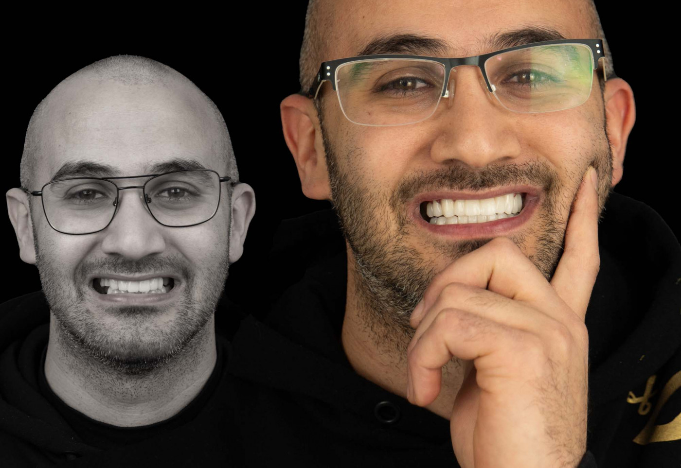 4 Albania Dental & Aesthetics - Turismo Dentale in Albania - Albania Dental Tourism