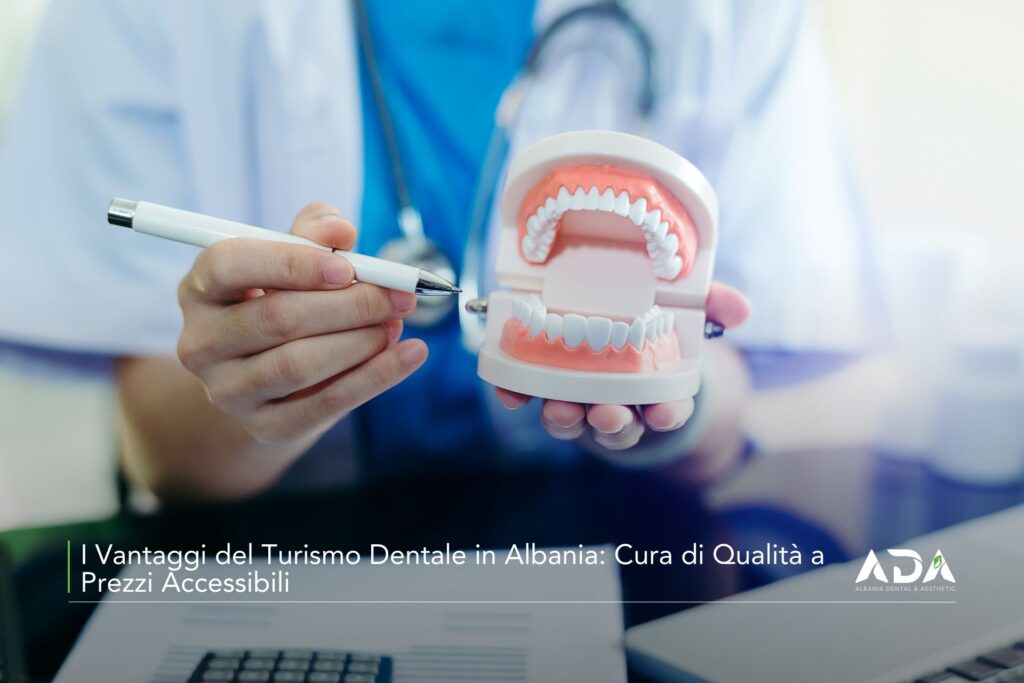 I Vantaggi del Turismo Dentale in Albania Cura di Qualita a Prezzi Accessibili Albania Dental & Aesthetics - Turismo Dentale in Albania - Albania Dental Tourism