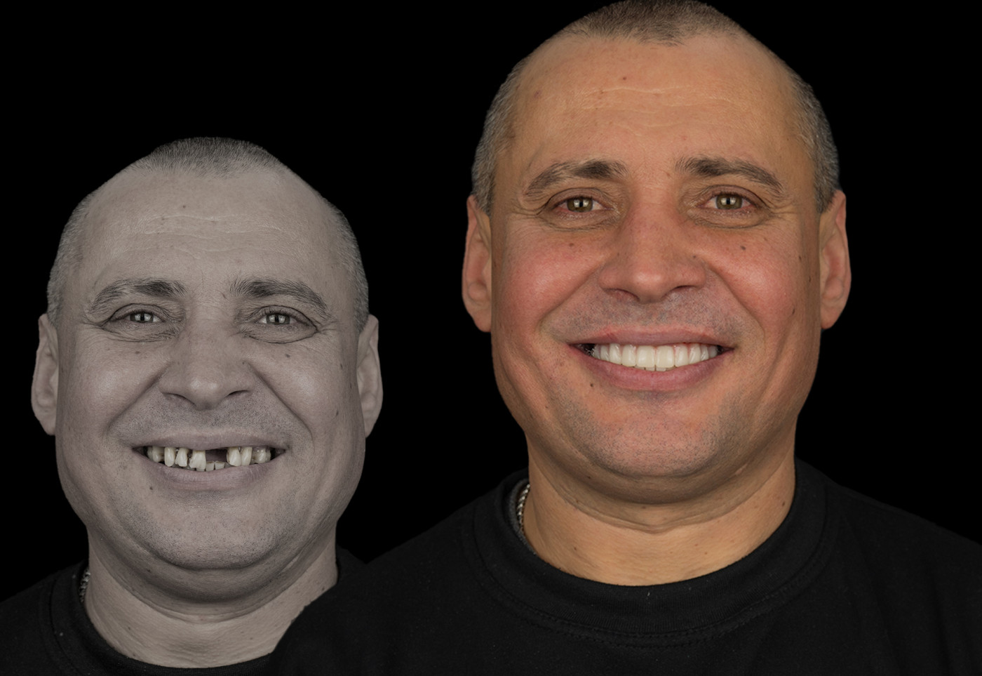 slider element 33 Albania Dental & Aesthetics - Turismo Dentale in Albania - Albania Dental Tourism