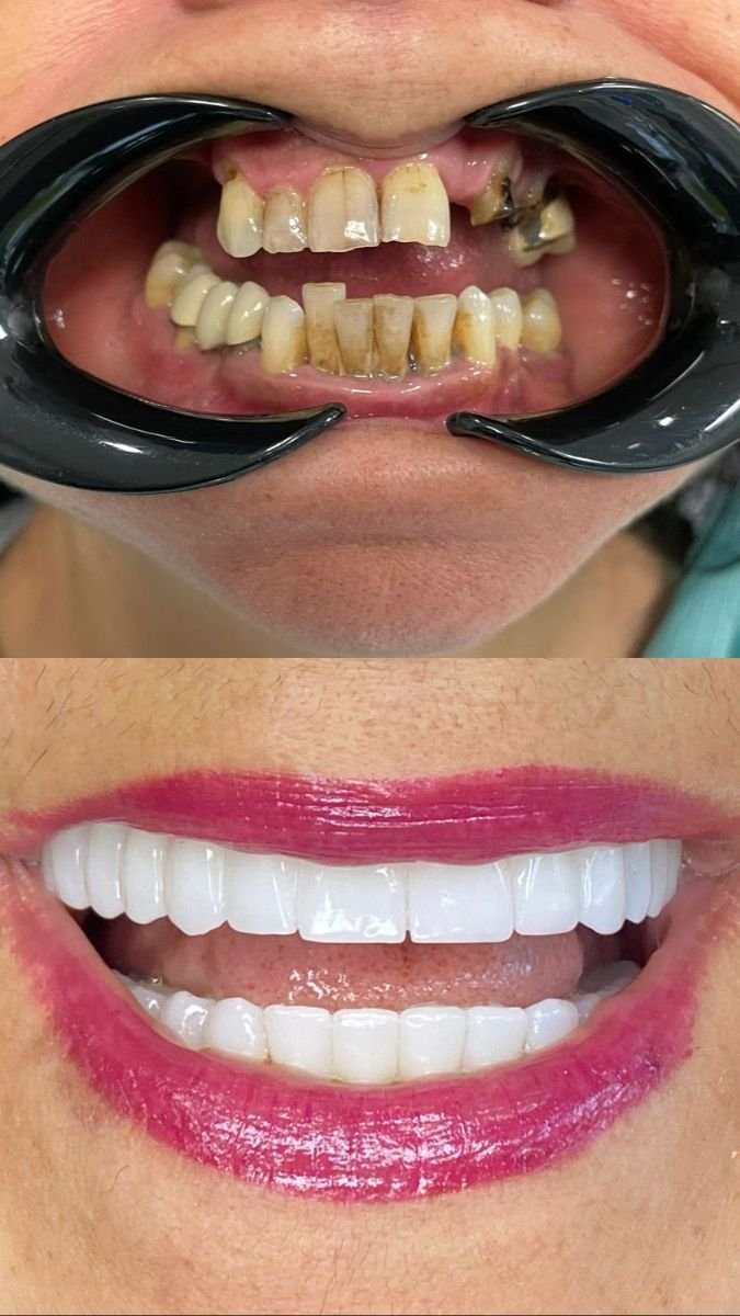 64bf938c1d77f Albania Dental & Aesthetics - Turismo Dentale in Albania - Albania Dental Tourism