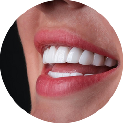 teeth part 3 Albania Dental & Aesthetics - Turismo Dentale in Albania - Albania Dental Tourism